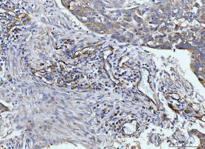 Anti-CD93 Antibody Boster Bio
