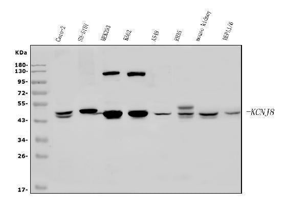 Anti-Kir6.1/KCNJ8 Antibody Picoband® Boster Bio
