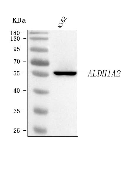Anti-ALDH1A2 Antibody Picoband® Boster Bio