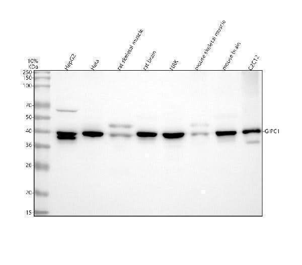 Anti-GIPC1 Antibody Picoband® Boster Bio