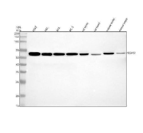 Anti-SGMS1 Antibody Picoband® Boster Bio