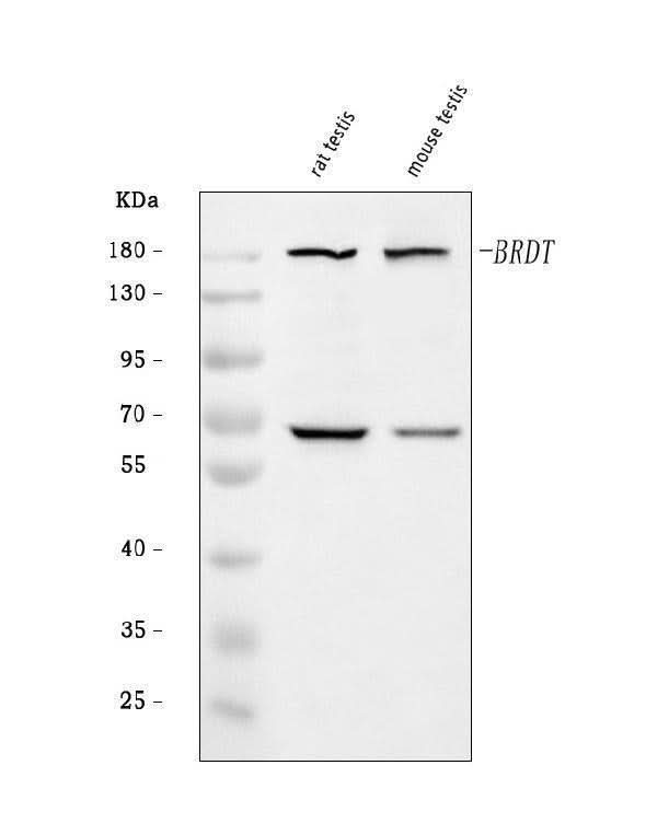 Anti-BRDT Antibody Picoband® Boster Bio