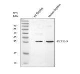 Anti-Flt3 ligand/Flt3lg Antibody Picoband® Boster Bio