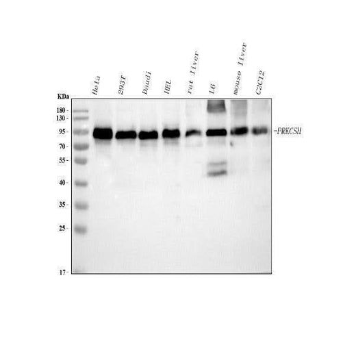 Anti-PRKCSH Antibody Picoband® Boster Bio