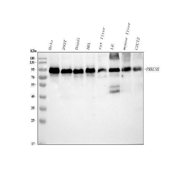 Anti-PRKCSH Antibody Picoband® Boster Bio
