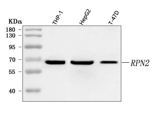 Anti-RPN2 Antibody Picoband® Boster Bio