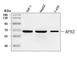 Anti-RPN2 Antibody Picoband® Boster Bio