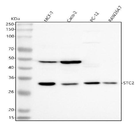 Anti-Stanniocalcin 2/STC2 Antibody Picoband® Boster Bio