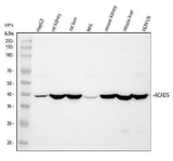 Anti-ACADS/SCAD Antibody Picoband® Boster Bio