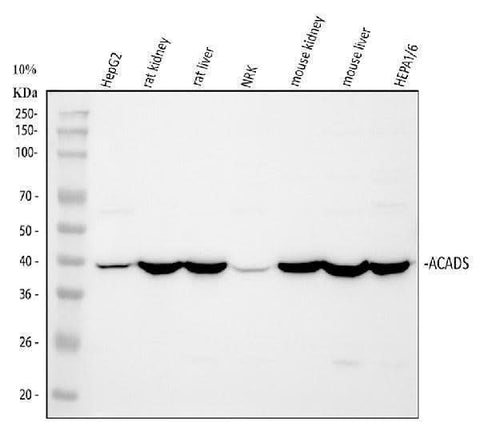 Anti-ACADS/SCAD Antibody Picoband® Boster Bio