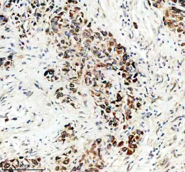Anti-TCIRG1 Antibody Boster Bio