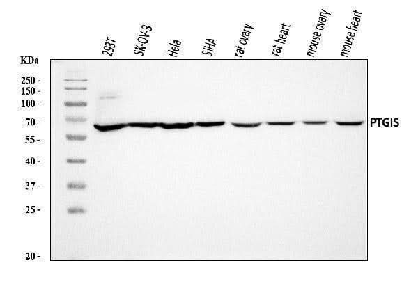 Anti-PTGIS/PGIS Antibody Picoband® Boster Bio