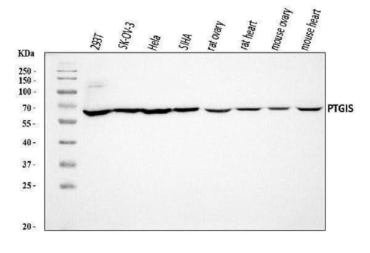 Anti-PTGIS/PGIS Antibody Picoband® Boster Bio