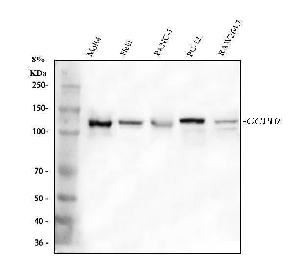 Anti-CP110/CCP110 Antibody Picoband® Boster Bio
