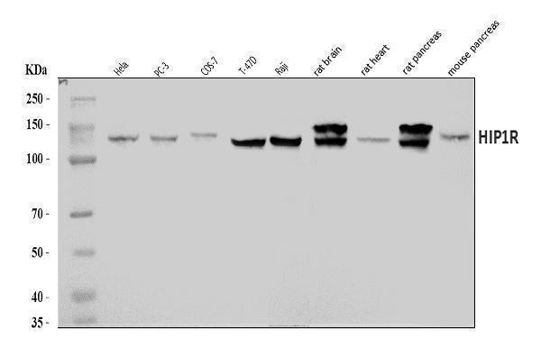 Anti-HIP1R Antibody Picoband® Boster Bio