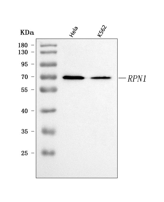 Anti-Ribophorin I/RPN1 Antibody Picoband® Boster Bio