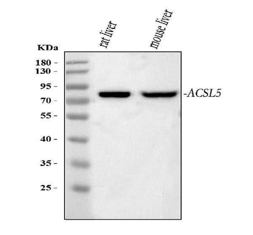 Anti-ACSL5 Antibody Picoband® Boster Bio