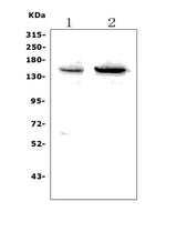 Anti-SENP6 Picoband® Antibody Boster Bio