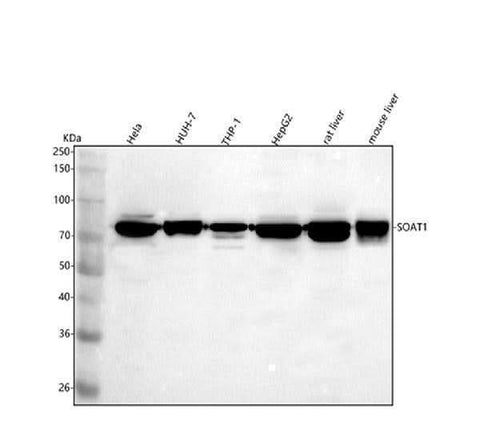 Anti-SOAT1 Antibody Picoband® Boster Bio
