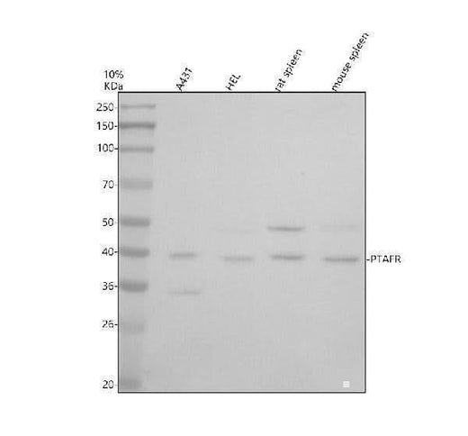 Anti-PTAFR Antibody Picoband® Boster Bio