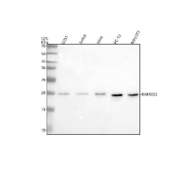 Anti-RARRES3/PLAAT4 Antibody Picoband® Boster Bio