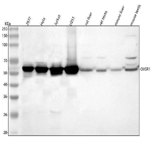 Anti-OXSR1 Antibody Picoband® Boster Bio