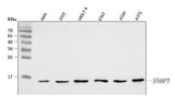 Anti-SSBP1 Antibody Picoband® Boster Bio