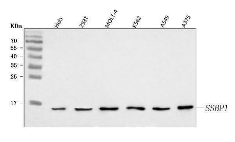 Anti-SSBP1 Antibody Picoband® Boster Bio