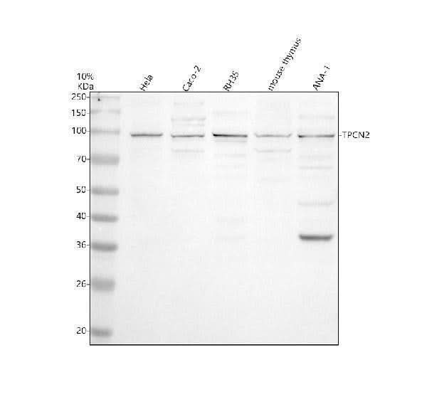 Anti-TPCN2 Antibody Picoband® Boster Bio
