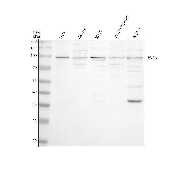 Anti-TPCN2 Antibody Picoband® Boster Bio