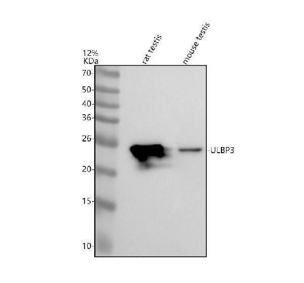 Anti-ULBP3 Antibody Picoband® Boster Bio