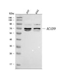 Anti-ACAD9 Antibody Picoband® Boster Bio
