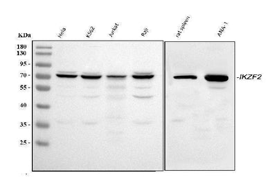 Anti-ZNFN1A2/HELIOS/IKZF2 Antibody Picoband® Boster Bio
