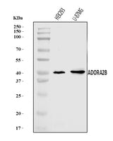 Anti-ADORA2B Antibody Picoband® Boster Bio