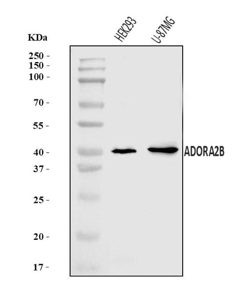 Anti-ADORA2B Antibody Picoband® Boster Bio