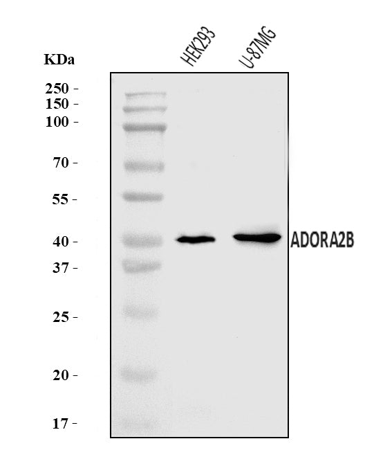 Anti-ADORA2B Antibody Picoband® Boster Bio