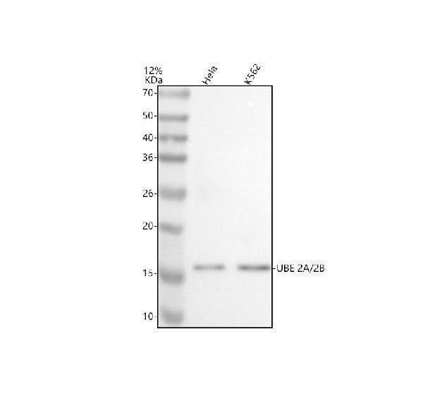 Anti-UBE2A/2B Antibody Picoband® Boster Bio