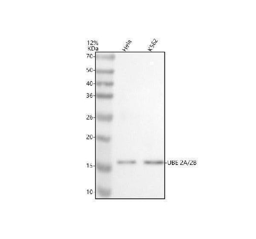 Anti-UBE2A/2B Antibody Picoband® Boster Bio