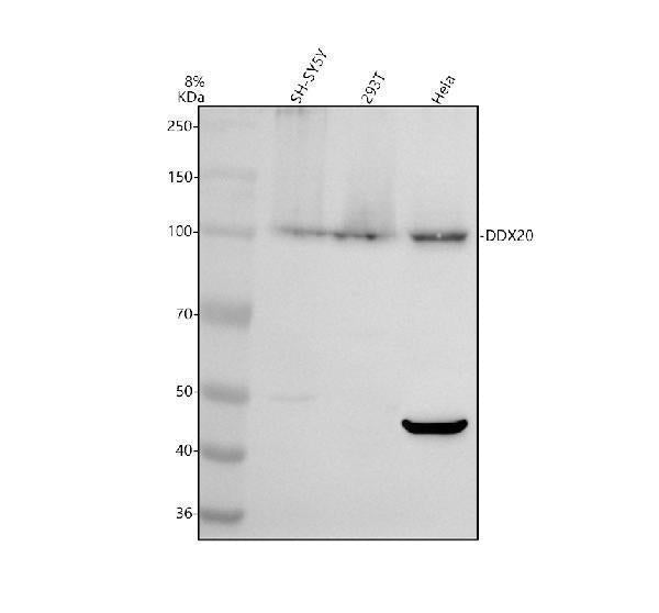 Anti-DDX20 Antibody Picoband® Boster Bio