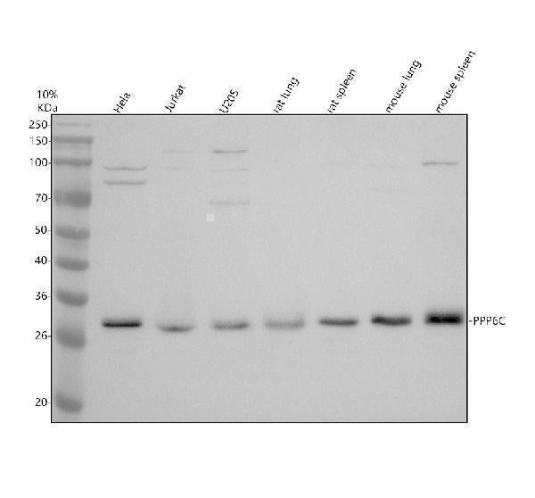 Anti-DNAJB11 Antibody Picoband® Boster Bio