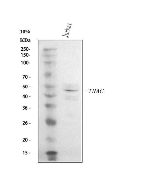 Anti-TCR alpha/TRAC Antibody Picoband® Boster Bio
