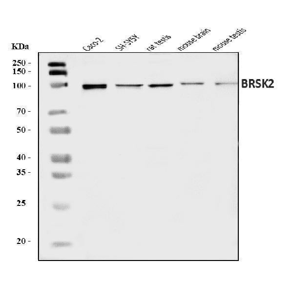Anti-BRSK2 Antibody Picoband® Boster Bio