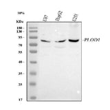 Anti-PLOD1 Antibody Picoband® Boster Bio