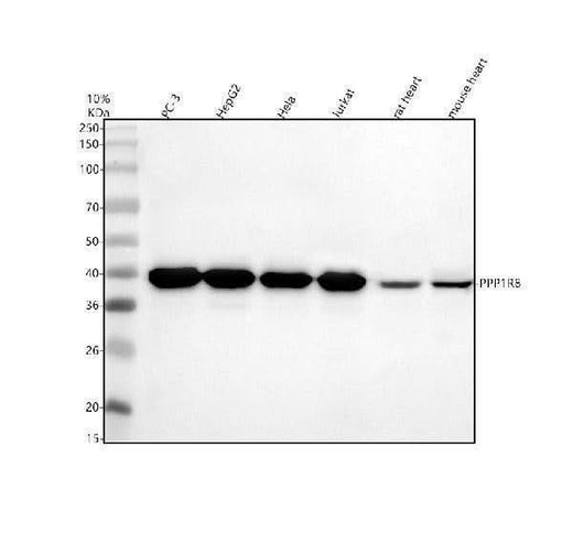 Anti-PPP1R8 Antibody Picoband® Boster Bio