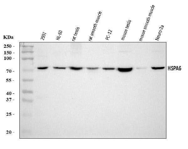 Anti-HSPA6 Antibody Picoband® Boster Bio
