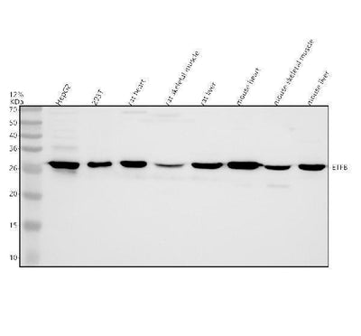 Anti-ETFB Antibody Picoband® Boster Bio