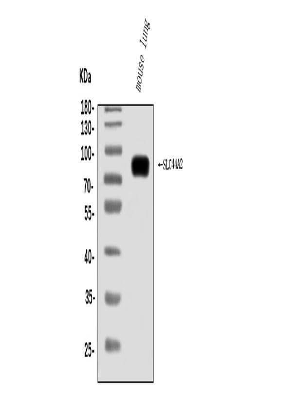 Anti-SLC44A2 Antibody Picoband® Boster Bio