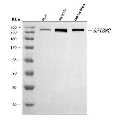 Anti-SPTBN2 Antibody Picoband® Boster Bio