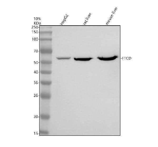 Anti-FTCD Antibody Picoband® Boster Bio