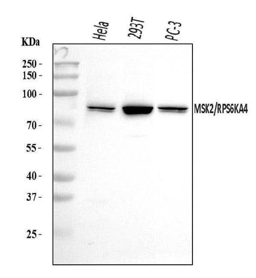 Anti-MSK2/RSK-B/RPS6KA4 Antibody Picoband® Boster Bio